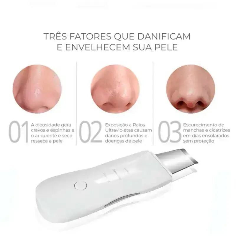 Aparelho de Peeling Facial | DermaPeel Pro - Limpeza profunda que rejuvenesce sua pele